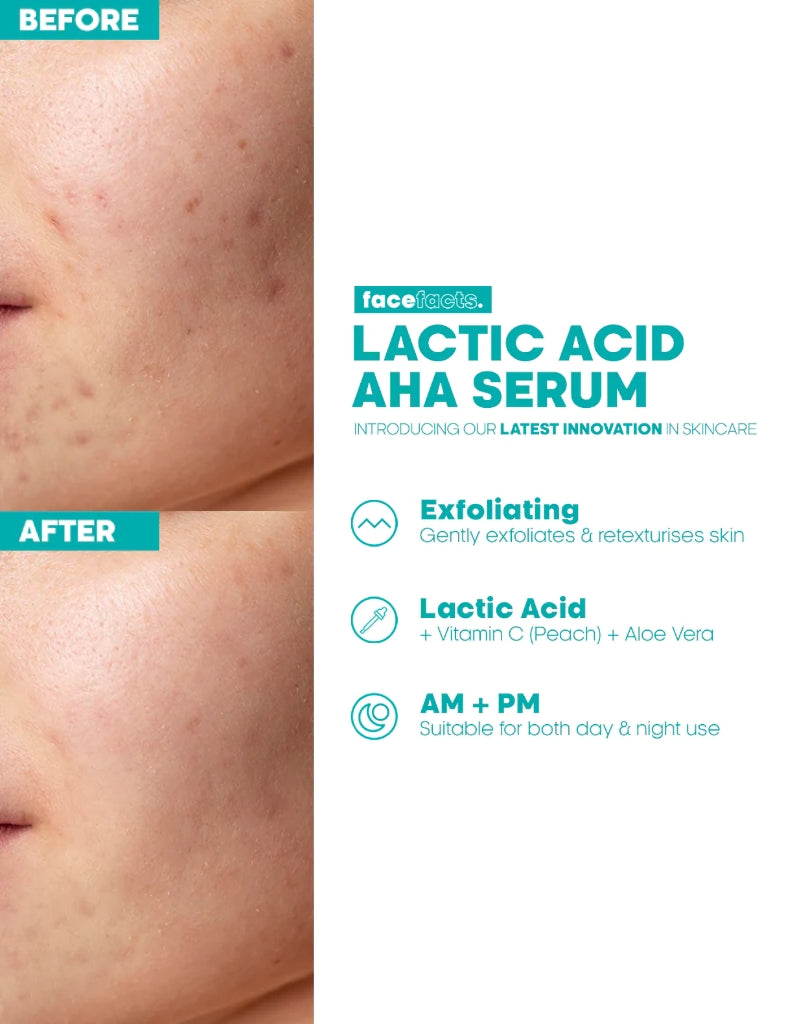 𝗙𝗮𝗰𝗲 𝗙𝗮𝗰𝘁𝘀 Lactic Acid Serum Glow & Resurface 30 ML