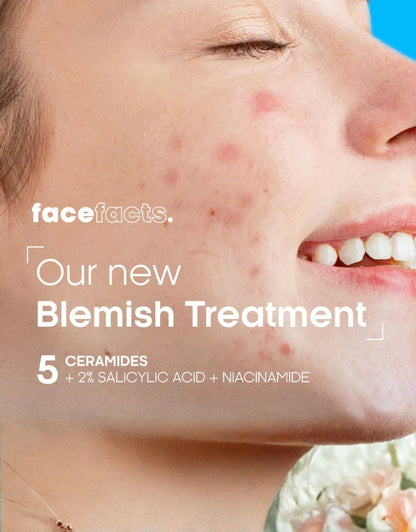𝗙𝗮𝗰𝗲 𝗙𝗮𝗰𝘁𝘀 Ceramide Blemish Treatment Gel 50 ML